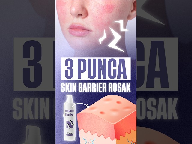 3 Punca Skin Barrier Rosak