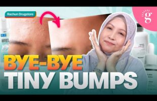 Cara Hilangkan Tiny Bumps Di Dahi & 4 Rekomendasi Produk Drugstore