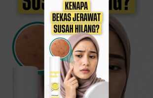 Kenapa Bekas Jerawat Susah Hilang? | Review HiKawan Bright Bulb Tone-Perfecting Face and Body Serum💡