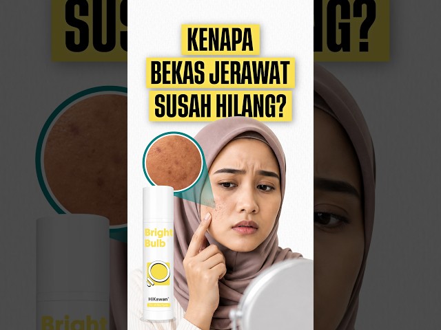Kenapa Bekas Jerawat Susah Hilang? | Review HiKawan Bright Bulb Tone-Perfecting Face and Body Serum💡